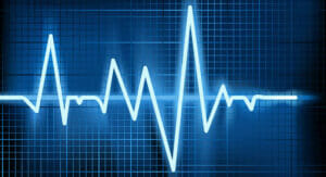 Caffeine and Heart Arrhythmias (Irregular Heartbeat)